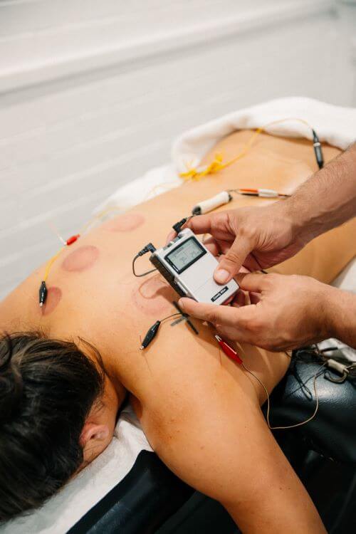 Electro Dry Needling at Results Based Physio